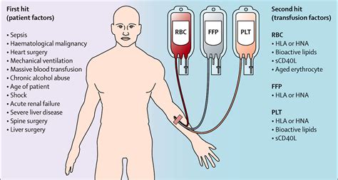 Transfusion-related acute lung injury: a clinical review - The Lancet