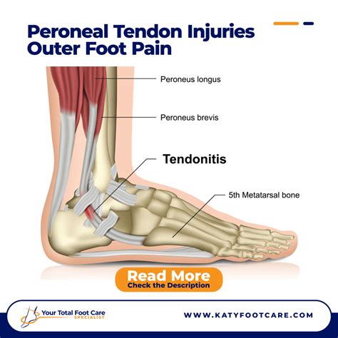 Tendons On Your Foot Top Sellers | emergencydentistry.com