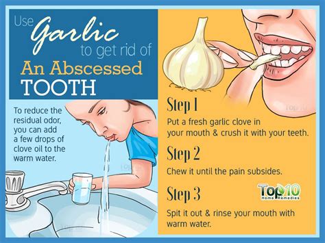 Home Remedies for an Abscessed Tooth | Top 10 Home Remedies