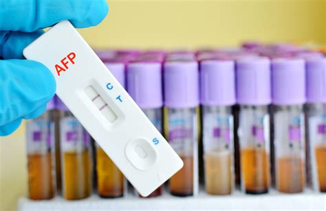 Understanding Alpha-Fetoprotein Test: Symptoms and Treatment