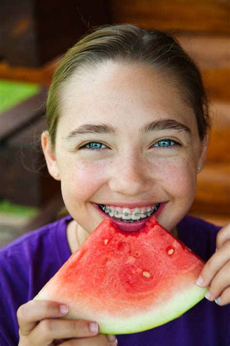 Tips for Eating With Braces | Greater Vancouver Orthodontics | BC ...