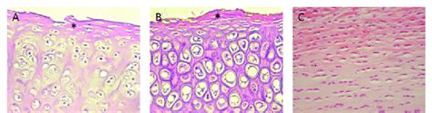 Cartilage Tissue Types