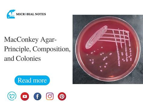 MacConkey Agar- Principle, Composition and Colonies