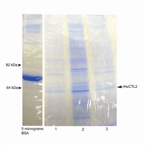 Coomassie blue staining of partially purified rHuCTL2 Samples 1,2 and 3... | Download Scientific ...