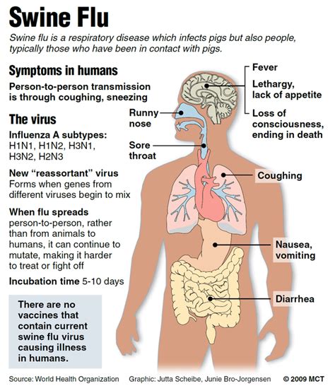 Prevention and home remedies of Swine Flu (H1N1)