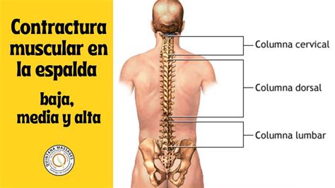 szalag kötél Vegyes dolor espalda media y costillas olcsó kiadás ...