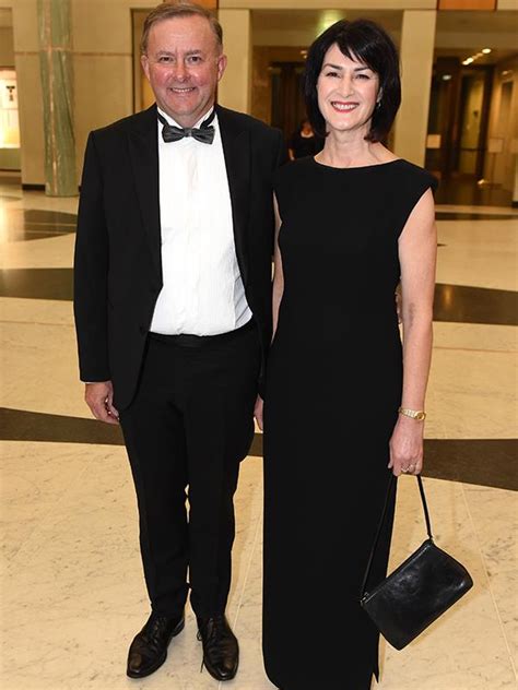 Who is Anthony Albanese's former wife Carmel Tebbutt? | Now To Love