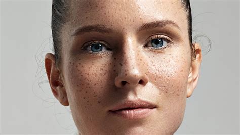 What Your Freckles Are Telling You About Your Skin - SHEfinds