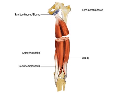 Hamstring Tendon