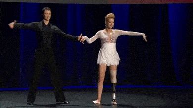 Bionic prosthetic allows disabled to run, climb and even dance - watch this TED talk!