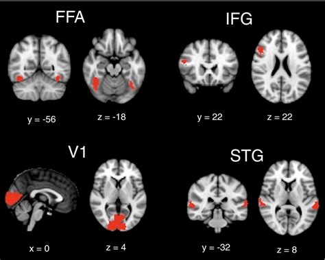 Functional masks of the fusiform face area (FFA), primary visual area... | Download Scientific ...