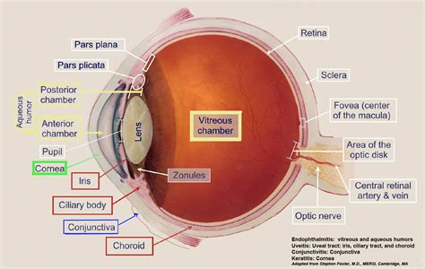 Endophthalmitis - Infectious Disease Advisor