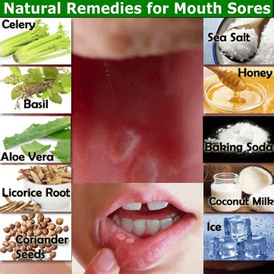 12 Natural Remedies for Mouth Sores that Work - NaturalRelieved