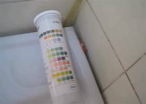 Urobilinogen in Urine - Test, Causes, Symptoms, Treatment