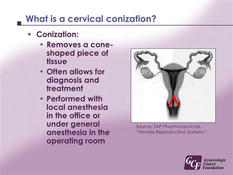 PPT - Cervical Cancer Prevention· Screening· Evaluation · Treatment PowerPoint Presentation - ID ...