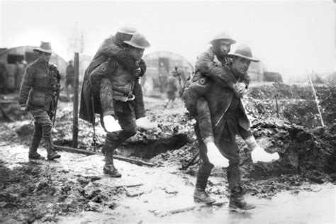 Trench Foot in World War I - HISTORY CRUNCH - History Articles, Biographies, Infographics ...