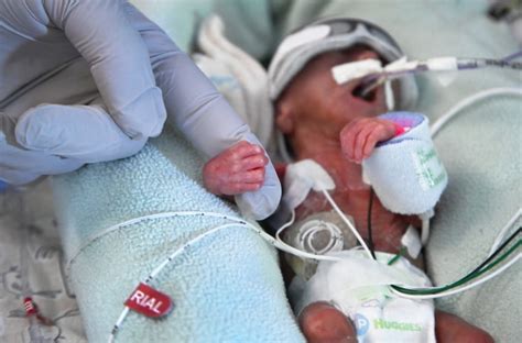 Premature births at an all-time high in the U.S., March of Dimes report ...