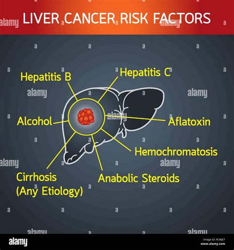 liver cancer risk factors vector logo icon illustration Stock Vector Image & Art - Alamy