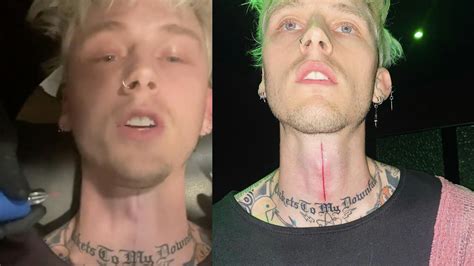 Machine Gun Kelly shares photos of gory-looking new neck tattoo — Kerrang!