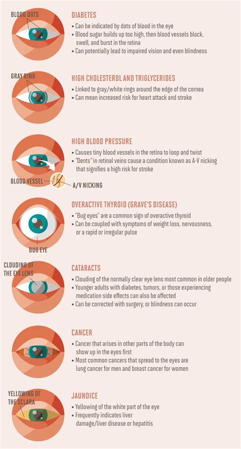 How to Read People's Eye Direction and Behavior in 2020 | Iridology, Chinese herbal medicine ...