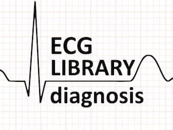 electrical alternans Archives • LITFL