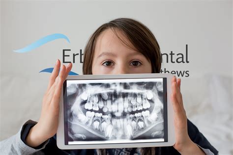 Advantages of Digital Radiography VS Traditional X-ray | Erbsville