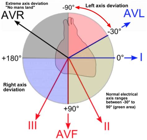 Heart left axis deviation causes, symptoms & treatment