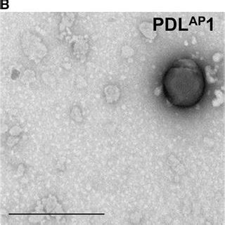 Electron microscopy of nanocomplexes. Negative staining transmission... | Download Scientific ...