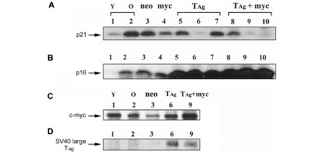 Expression of the p21 and p16 proteins. Expression of the p21 and p16... | Download Scientific ...