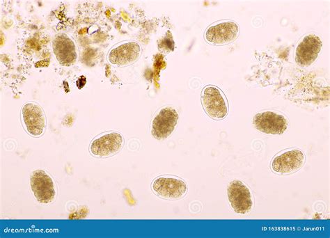 Eggs of Hookworm in Human Stool Stock Image - Image of human, organism ...