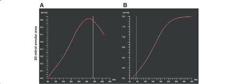 Dynamic model of the mitral valve in Barlow disease (a) and FED (b ...