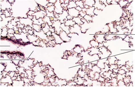 Histology of Terminal and Respiratory Bronchioles and Alveoli Diagram | Quizlet