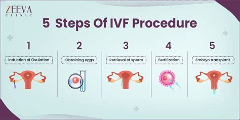 IVF Procedure Step By Step Guide