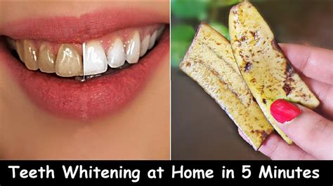 Teeth Whitening at Home | Whiten Yellow Teeth & Remove Plaque ...