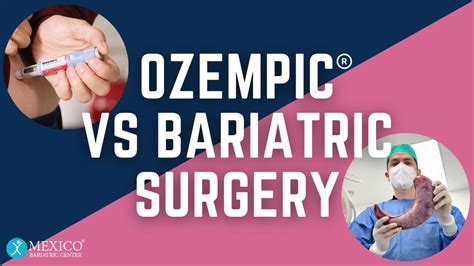 Ozempic or Bariatric Surgery: Which Option Is Best?