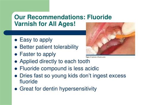 Topical Fluoride Varnish Cpt Code at Levi Gonzales blog