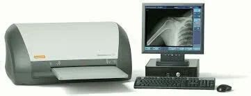 CR X-Ray Machine at Rs 800000 | Carestream CR System in Patna | ID ...