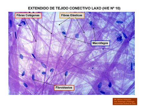 Tejido Conjuntivo Fibroblastos Tejido Conectivo | Images and Photos finder