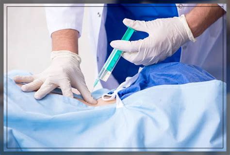 Epidural Injection: What is it, Procedure, and More - Engiomed