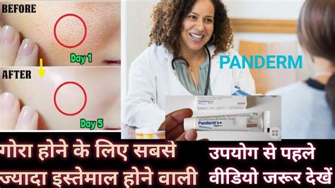 Panderm ++ Cream Uses & Side Effects| अगर गोरा होने के लिए यह क्रीम यूज़ कर रहे है तो यह वीडियो ...