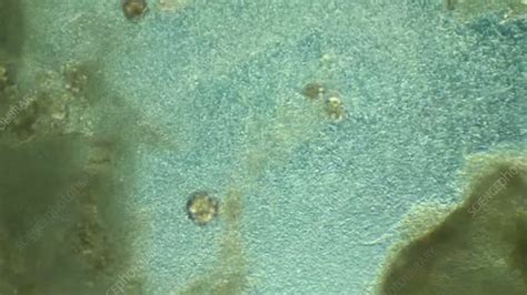 Bacteria shimmering in pond water - Stock Video Clip - K003/5582 ...