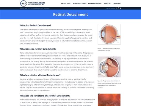 Retinal Detachment - Retina-Vitreous Surgeons of CNY