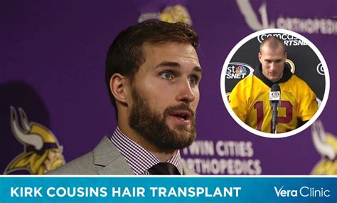 Kirk Cousins Hair Transplant: A New Look for the NFL Star