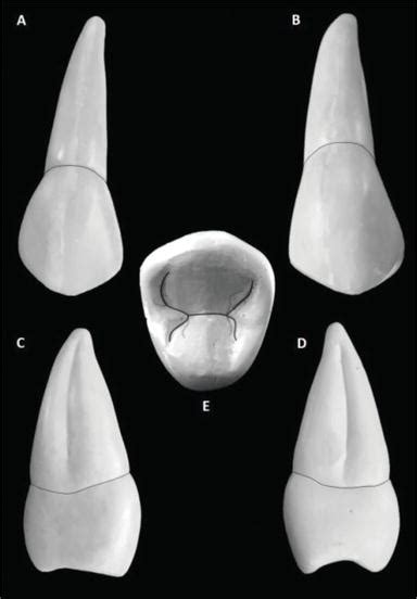 The Permanent Maxillary and Mandibular Premolar Teeth | IntechOpen