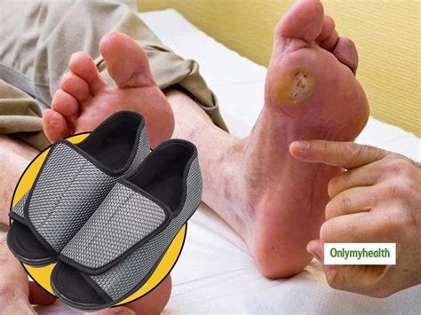 Diabetic Foot Treatment: Try Diabetic Shoes For Comfort And Health ...