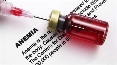 Be aware of types, symptoms of anemia