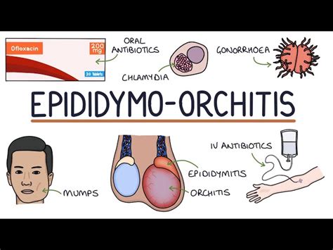 Epididymitis Orchitis