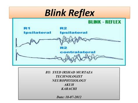 Blink reflex