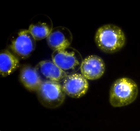 Therapeutic bioactive cerium oxide nanoparticles | UNSW Research