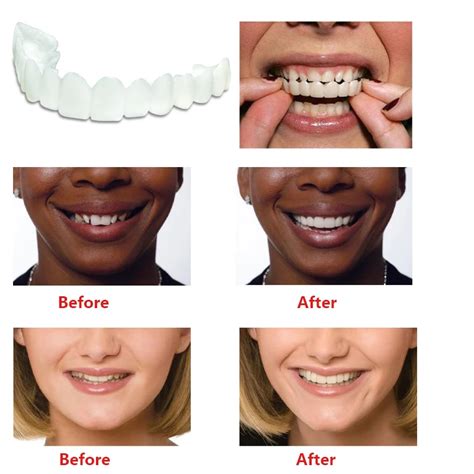 Teeth Whitening Snap On Smile Teeth Cosmetic Denture Instant Perfect ...